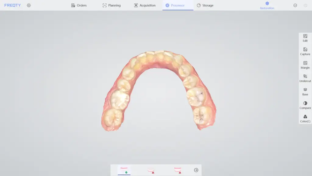 Vista de Boca escaneada en 3d con Escáner Intraoral